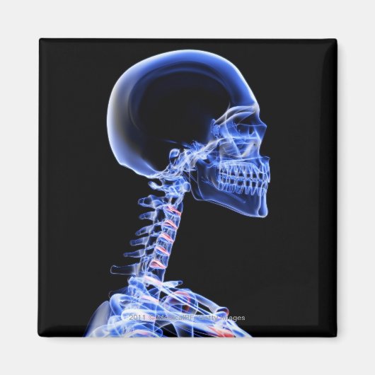 Röntgenaufnahme der Knochen im Nacken Magnet (Vorne)