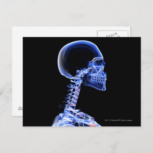 Röntgenaufnahme der Knochen im Nacken Postkarte (Vorne/Hinten)