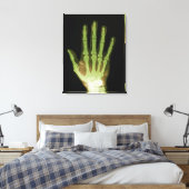 Röntgenaufnahme der menschlichen Hand Leinwanddruck (Insitu (Schlafzimmer))