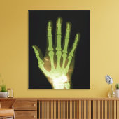 Röntgenaufnahme der menschlichen Hand Leinwanddruck (Insitu (Wohnzimmer))