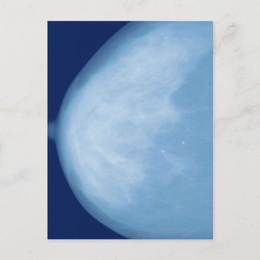 Röntgenaufnahme der weiblichen Brust, Seitenansich Postkarte (Vorderseite)