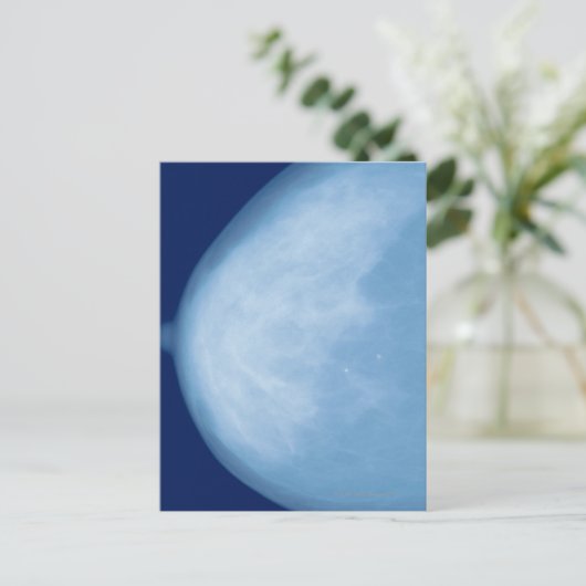 Röntgenaufnahme der weiblichen Brust, Seitenansich Postkarte (Stehend Vorderseite)