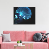 Röntgenaufnahme des Gehirns in einem Schädel Leinwanddruck (Insitu (Wohnzimmer))