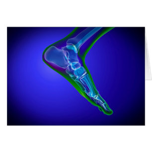 Röntgenaufnahme des menschlichen Fußes 1