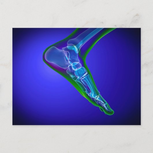 Röntgenaufnahme des menschlichen Fußes 1 Postkarte (Vorderseite)