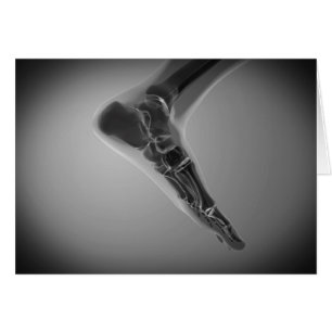 Röntgenaufnahme des menschlichen Fußes 4