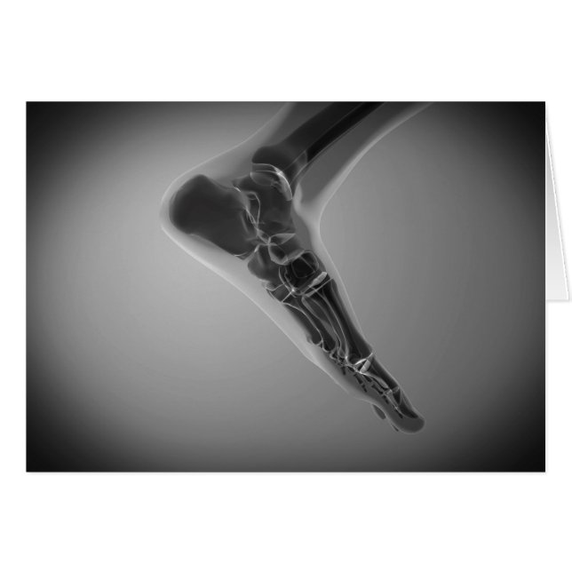 Röntgenaufnahme des menschlichen Fußes 4 (Vorderseite (Horizontal))