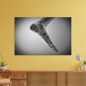 Röntgenaufnahme des menschlichen Fußes 4 Leinwanddruck (Insitu (Wohnzimmer))