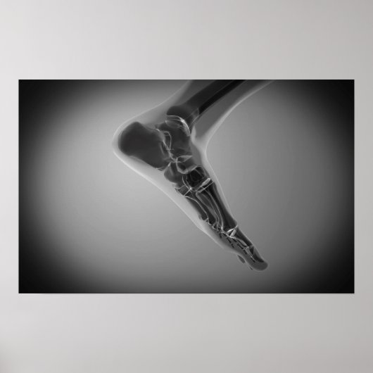 Röntgenaufnahme des menschlichen Fußes 4 Poster (Vorne)