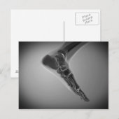 Röntgenaufnahme des menschlichen Fußes 4 Postkarte (Vorne/Hinten)