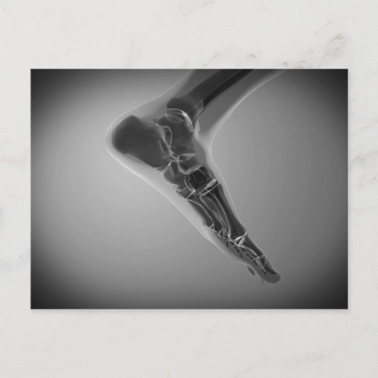 Röntgenaufnahme des menschlichen Fußes 4 Postkarte (Vorderseite)