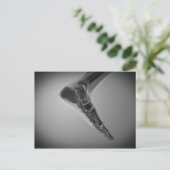 Röntgenaufnahme des menschlichen Fußes 4 Postkarte (Stehend Vorderseite)