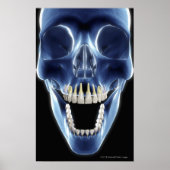 Röntgenaufnahme mit menschlichen Zähnen Poster (Vorne)
