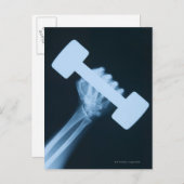 Röntgenbild der menschlichen Hand mit Gewicht, nah Postkarte (Vorne/Hinten)