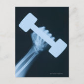 Röntgenbild der menschlichen Hand mit Gewicht, nah Postkarte (Vorderseite)