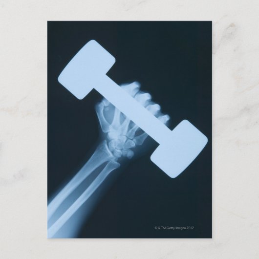 Röntgenbild der menschlichen Hand mit Gewicht, nah Postkarte (Vorderseite)
