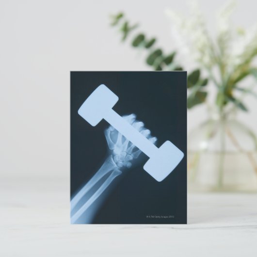 Röntgenbild der menschlichen Hand mit Gewicht, nah Postkarte (Stehend Vorderseite)