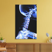 Röntgenbild der Nackenknochen Leinwanddruck (Insitu (Wohnzimmer))