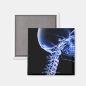 Röntgenbild der Nackenknochen Magnet (Vorderseite/Rückseite)