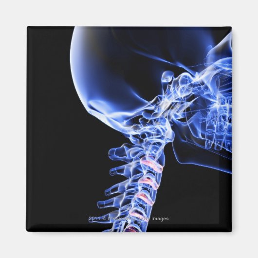 Röntgenbild der Nackenknochen Magnet (Vorne)