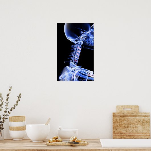 Röntgenbild der Nackenknochen Poster (Küche)