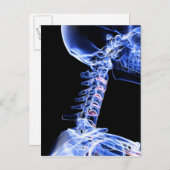 Röntgenbild der Nackenknochen Postkarte (Vorne/Hinten)