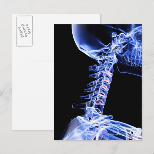 Röntgenbild der Nackenknochen Postkarte (Vorne/Hinten)