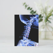 Röntgenbild der Nackenknochen Postkarte (Stehend Vorderseite)