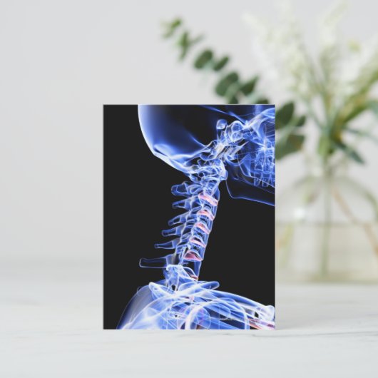 Röntgenbild der Nackenknochen Postkarte (Stehend Vorderseite)