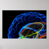 Röntgenbild des Gehirns Poster (Vorne)