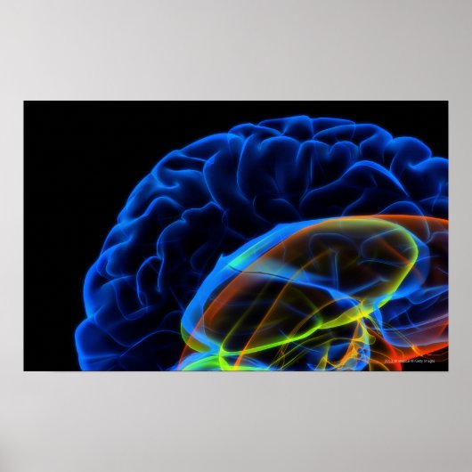 Röntgenbild des Gehirns Poster (Vorne)