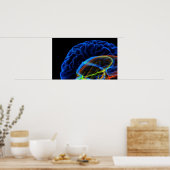 Röntgenbild des Gehirns Poster (Küche)