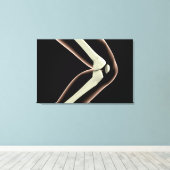 Röntgenbild des Knies 1 Leinwanddruck (Insitu (Holzboden))