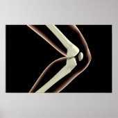 Röntgenbild des Knies 1 Poster (Vorne)