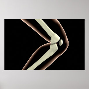 Röntgenbild des Knies 1 Poster
