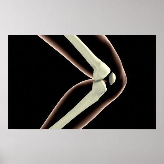 Röntgenbild des Knies 1 Poster (Vorne)