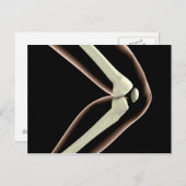 Röntgenbild des Knies 1 Postkarte (Vorne/Hinten)