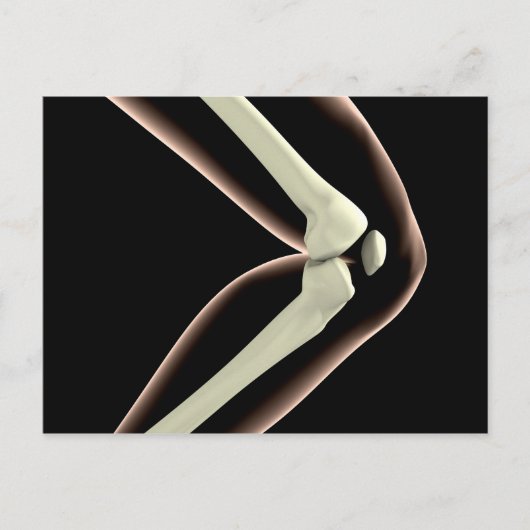 Röntgenbild des Knies 1 Postkarte (Vorderseite)