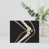 Röntgenbild des Knies 1 Postkarte (Stehend Vorderseite)