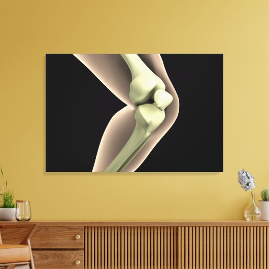 Röntgenbild des Knies 2 Leinwanddruck (Insitu (Wohnzimmer))
