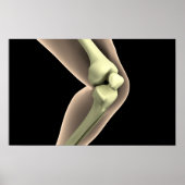 Röntgenbild des Knies 2 Poster (Vorne)