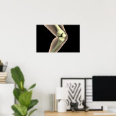 Röntgenbild des Knies 2 Poster (Heimbüro)