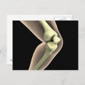 Röntgenbild des Knies 2 Postkarte (Vorne/Hinten)