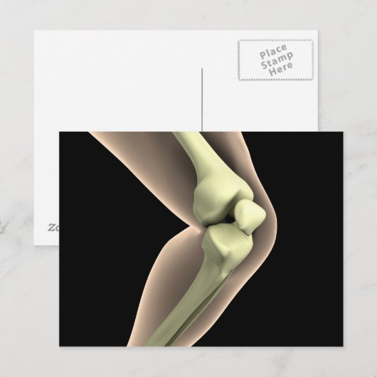 Röntgenbild des Knies 2 Postkarte (Vorne/Hinten)