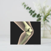 Röntgenbild des Knies 2 Postkarte (Stehend Vorderseite)