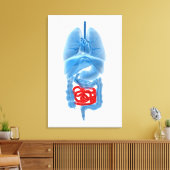 Röntgenbild interner Organe mit kleinen Leinwanddruck (Insitu (Wohnzimmer))