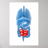 Röntgenbild interner Organe mit kleinen Poster (Vorne)