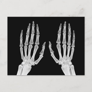 Röntgenbild Skeletthände menschliche Anatomie Foto Postkarte