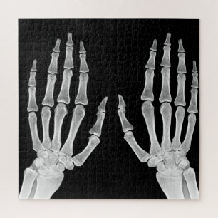 Röntgenbild Skeletthände menschliche Anatomie Foto Puzzle