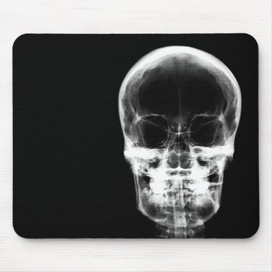 RÖNTGENBLICK-SKELETON SCHÄDEL - B&W MOUSEPAD (Vorne)